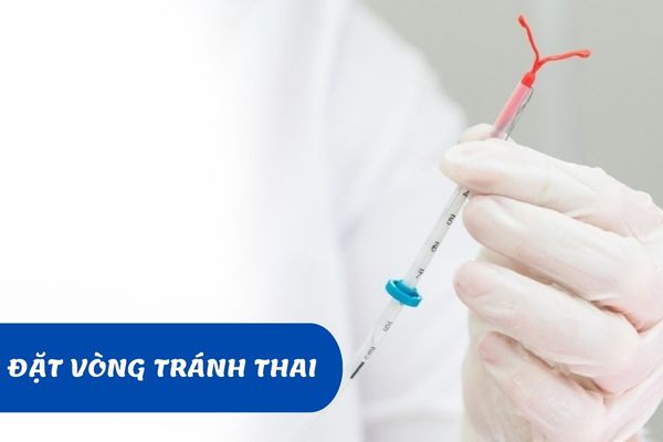 Lưu ý cần biết khi đặt vòng tránh thai – Địa chỉ đặt vòng uy tín và đáng tin cậy