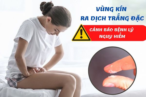 Vùng kín ra dịch trắng đặc – Cảnh báo nhiều bệnh lý nguy hiểm ở nữ giới