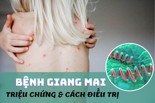 Bệnh giang mai là gì? Biểu hiện và cách chữa trị hiệu quả