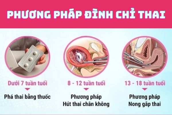 [Giải đáp] Thai phụ có nên thực hiện phá thai tại nhà không?