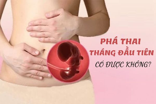 Tìm hiểu quy trình phá thai an toàn, đạt chuẩn Quốc tế