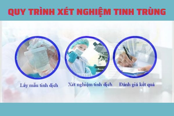 Quy trình xét nghiệm tinh trùng đúng chuẩn