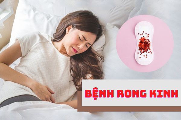 Bệnh rong kinh – Bệnh lý nguy hiểm chị em cần lưu ý