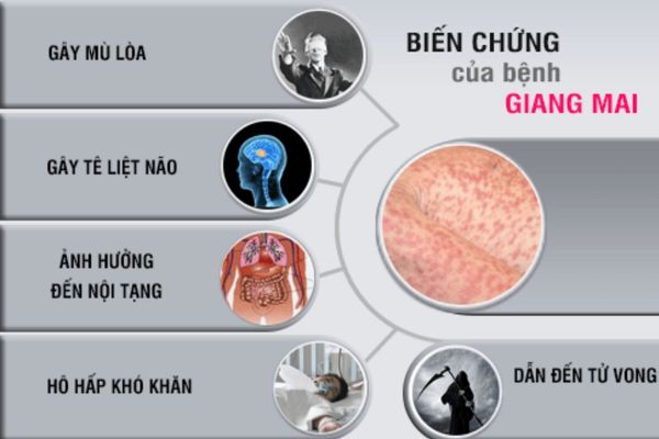 Giang mai gây ra nhiều biến chứng nguy hiểm