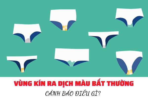 Vùng kín ra dịch màu bất thường cảnh báo điều gì?