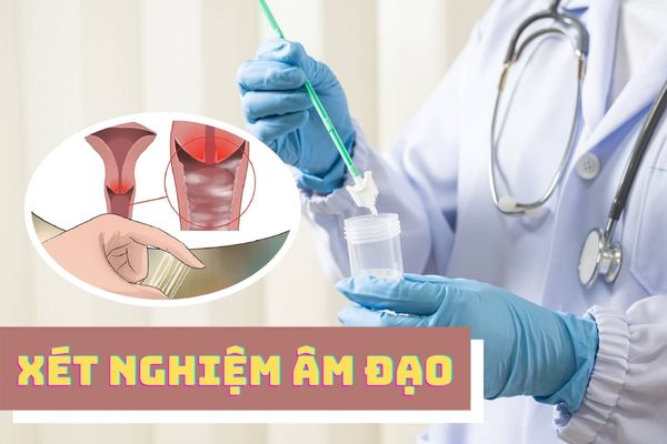 Triệu chứng bệnh lậu nữ giới và cách điều trị hiệu quả