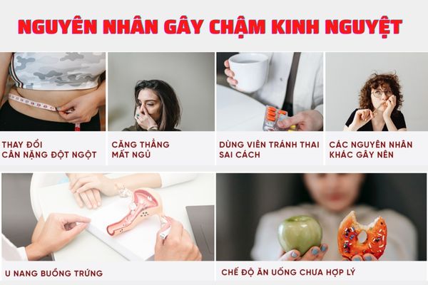 Chậm kinh nguyệt ở nữ giới do nhiều nguyên nhân khác nhau gây ra