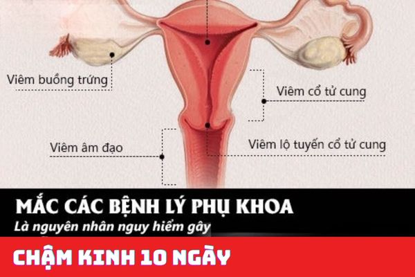 Chậm kinh 10 ngày do các bệnh phụ khoa gây nên