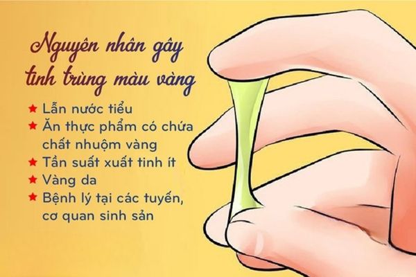 Có rất nhiều nguyên nhân khác nhau dẫn đến tinh dịch có màu vàng