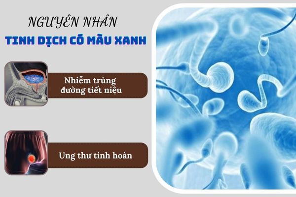 Tinh dịch có màu xanh do nhiều nguyên nhân khác nhau gây ra