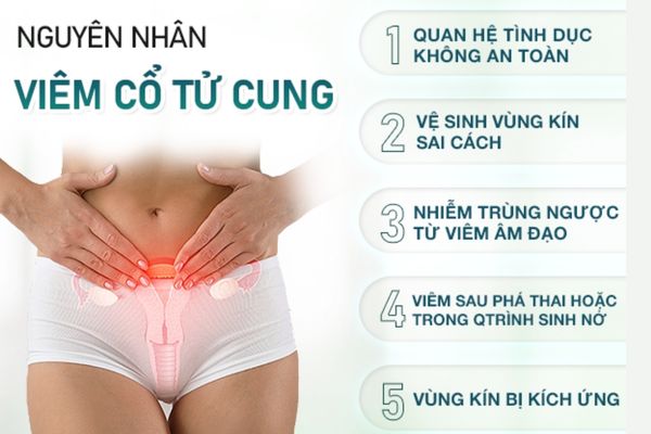 Có rất nhiều nguyên nhân dẫn đến viêm cổ tử cung