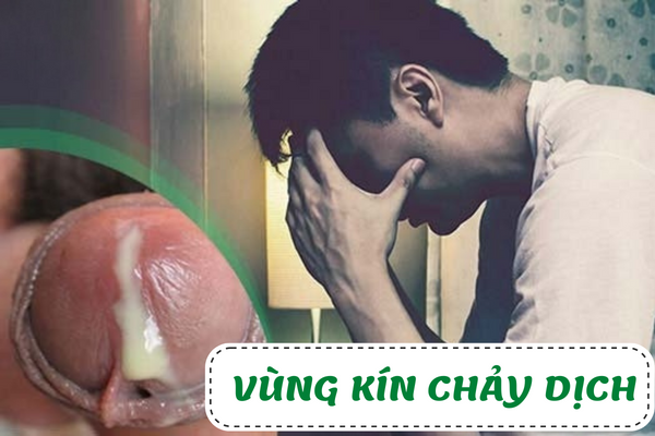 Nguyên nhân vùng kín chảy dịch bất thường cần lưu ý