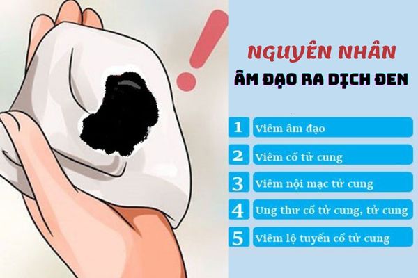 Nổi hạt trắng sinh dục là bị bệnh gì?