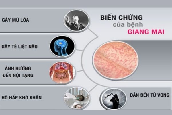 Bệnh giang mai gây ra nhiều nguy hiểm đến sức khỏe người bệnh