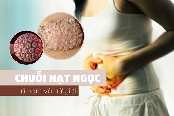 Những điều cần biết về chuỗi hạt ngọc ở nam và nữ giới