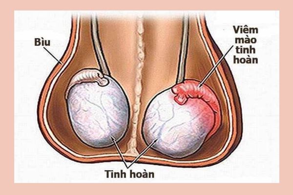 Benh-nam Gioi-thuong-gap (3)