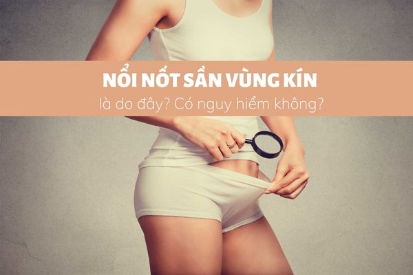 Nổi nốt sần vùng kín là bị gì? Có nguy hiểm không?