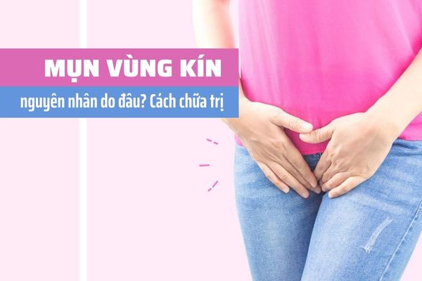 Nổi mụn vùng kín nguyên nhân do đâu? Cách chữa trị