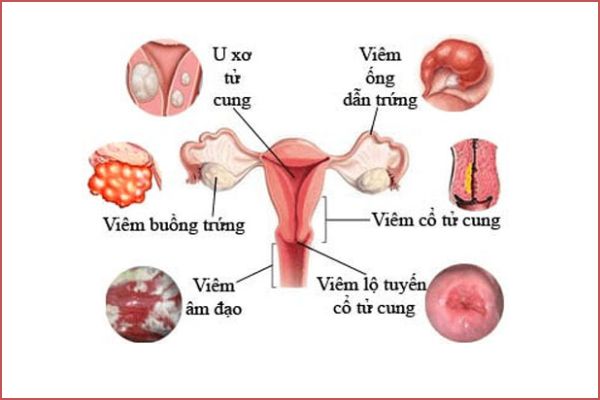 Vo-sinh-o-nu-noi-dau-biet-to-cung-ai-1