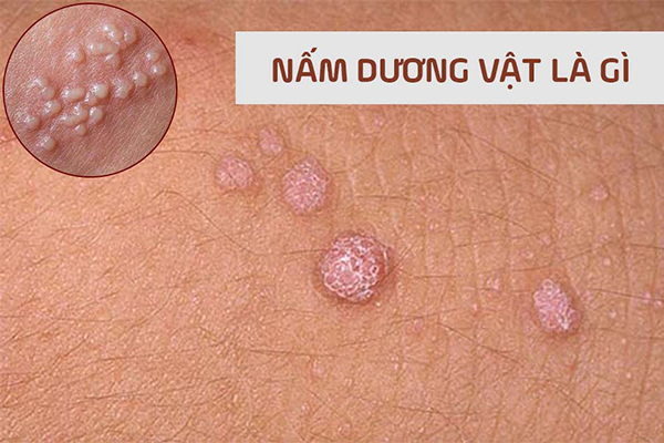 Nam_duong_vat_la_gi