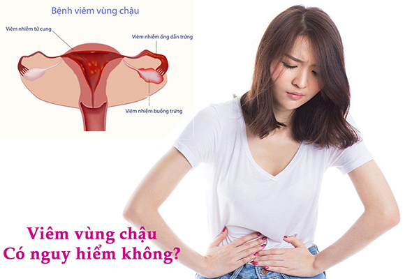 Viêm vùng chậu: Nguyên nhân và cách điều trị hiệu quả