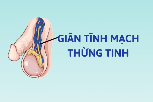 Benh-o-tinh-hoan-su-be-tac-lon-cua-phai-manh-4