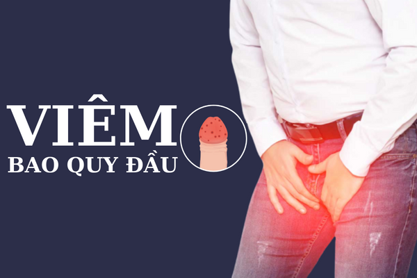 Viêm bao quy đầu – Tổng hợp thông tin cần lưu ý