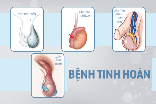 Benh-nam-khoa-thuong-gap-va-cach-ho-tro-dieu-tri-hieu-qua-2