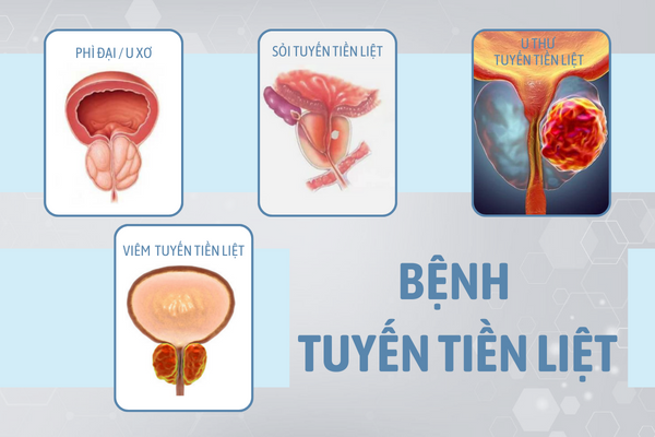 Benh-nam-khoa-thuong-gap-va-cach-ho-tro-dieu-tri-hieu-qua-5