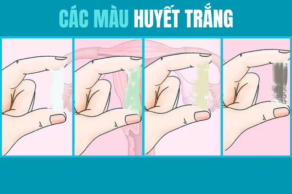 Dung-bo-qua-cac-mau-huyet-trang-bat-thuong-1