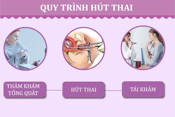 Quy-trinh-hut-thai-chan-khong-an-toan-tai-phong-kham-truong-hai