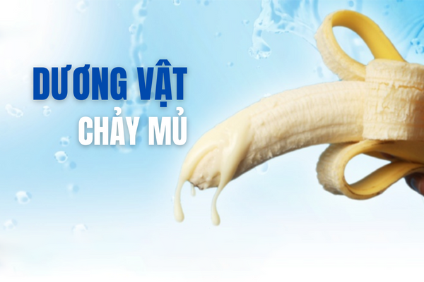 Duong-vat-chay-mu-la-bi-gi-0