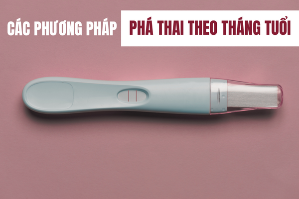 Gợi ý các phương pháp phá thai theo tháng tuổi