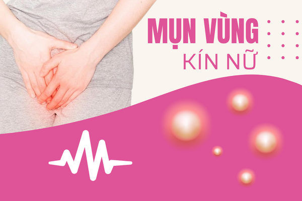 Nổi mụn vùng kín nữ đừng bỏ qua