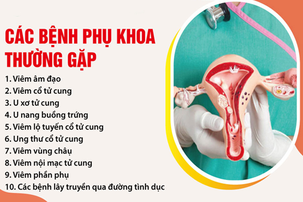 Hình ảnh về các bệnh phụ khoa thường gặp