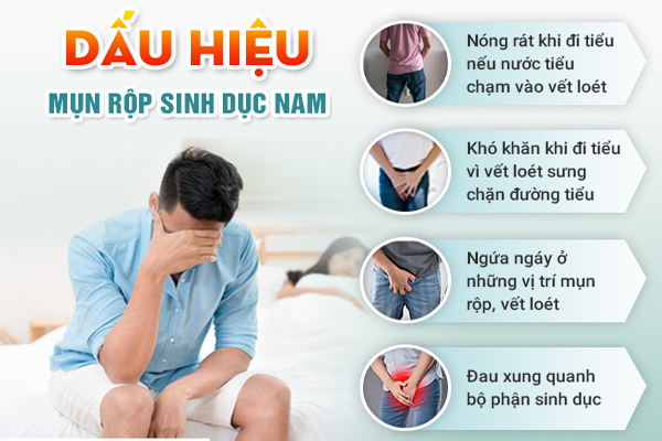 Dấu hiệu nhận biết bệnh mụn rộp nam