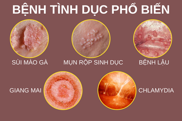 Benh-vien-chua-benh-tinh-duc-uy-tin-tai-tp-da-nang-1