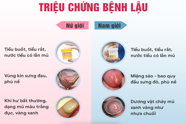 Nhận biết triệu chứng bệnh lậu