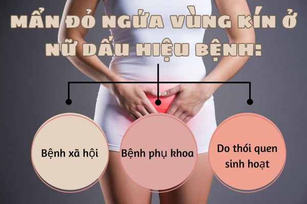 Mẩn đỏ ngứa vùng kín ở nữ – Dấu hiệu cảnh báo bệnh lý nguy hiểm