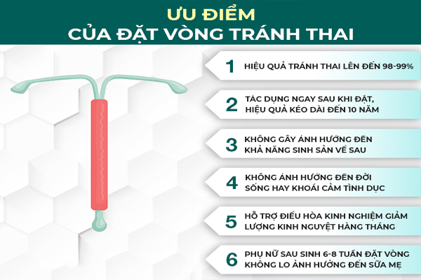 Những ưu điểm của phương pháp đặt vòng