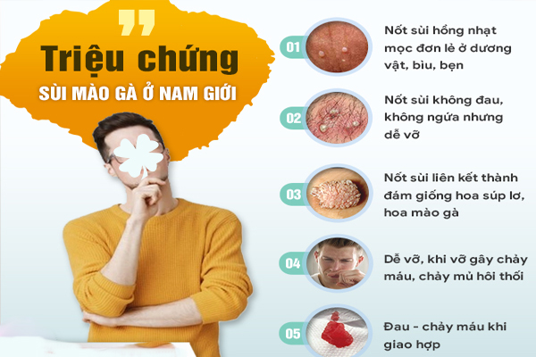 Nhận biết dấu hiệu sùi mào gà biểu hiện trên cơ thể