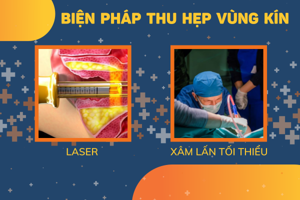 Thu-hep-vung-kin-ban-da-biet-chua-3