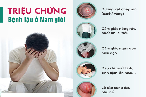 Triệu chứng và hình ảnh bệnh lậu ở nam giới