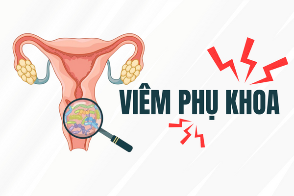 Viêm phụ khoa – Dấu hiệu, nguyên nhân và khắc phục