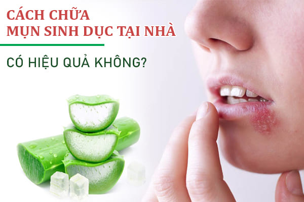 Giải đáp: Cách chữa mụn sinh dục tại nhà có hiệu quả không?