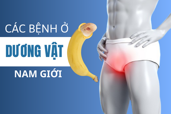 Các bệnh ở dương vật nam giới cần lưu ý.