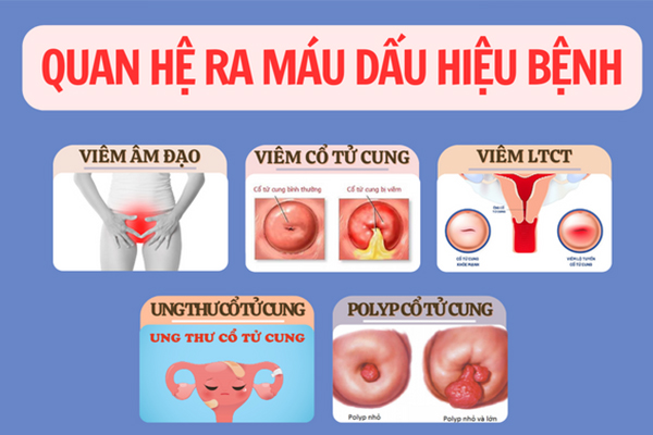 Cẩn trọng với hiện tượng quan hệ ra máu ở nữ giới