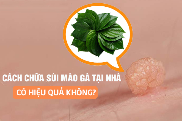 Tìm hiểu về cách chữa sùi mào gà tại nhà