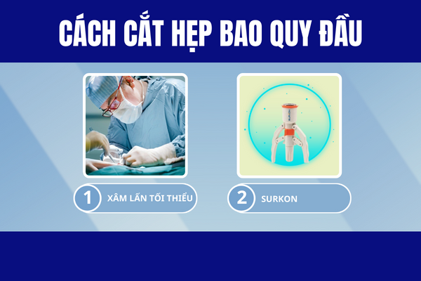 Dia-chi-cat-hep-bao-quy-dau-uy-tin-va-phai-chang-2