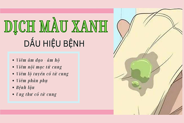 Dịch màu xanh – Dấu hiệu bệnh phụ khoa nguy hiểm